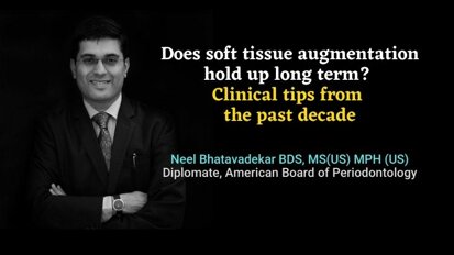 Does soft tissue augmentation hold up long term? Clinical tips from the past decade