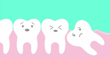 Early removal of unerupted wisdom teeth results in positive gum outcomes