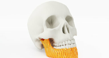 New comprehensive review of 3D printing in oral and maxillofacial surgery