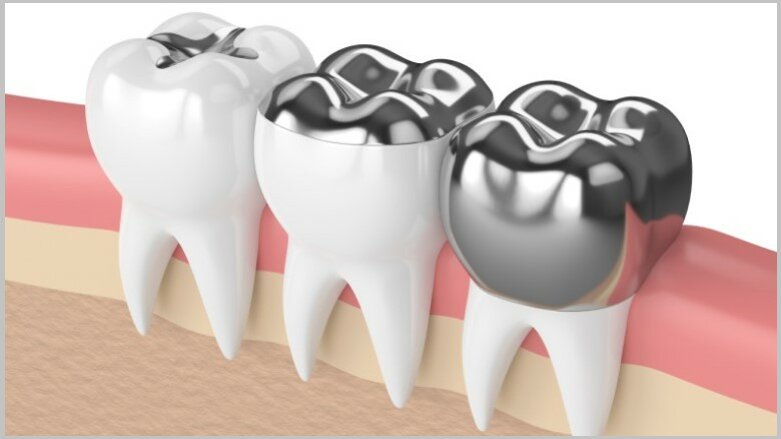 NGO releases briefing about phasing down dental amalgam