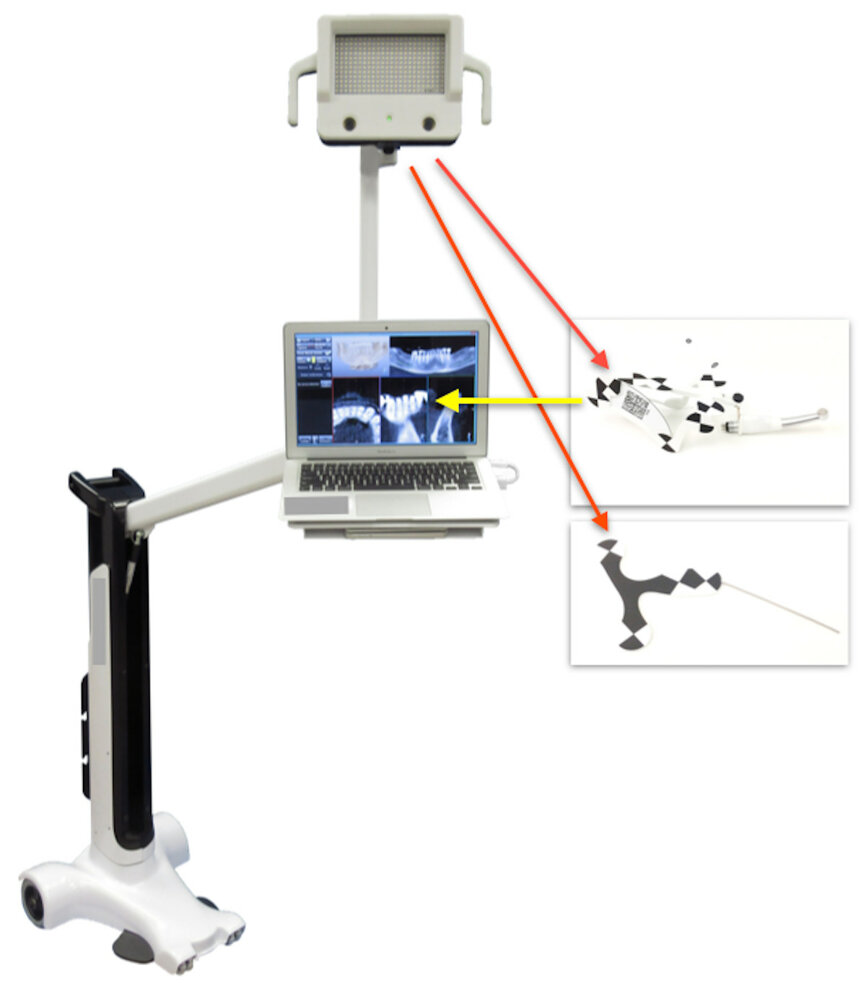 Fig. 2: An optical tracking sensor tracks the Jaw-Tracker, Tracer Tracker, Drill-Tracker and instrument.