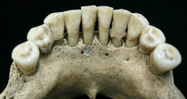 Pesquisadores descobrem pigmentos de lápis-lazúli na mandíbula da mulher medieval