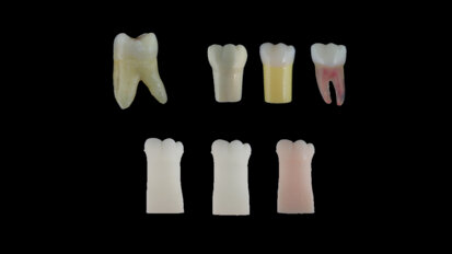 Estudantes de Odontologia precisam de dentes artificiais de melhor qualidade para a prática