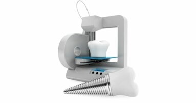 3D printen in de tandheelkunde: een revolutie in wording