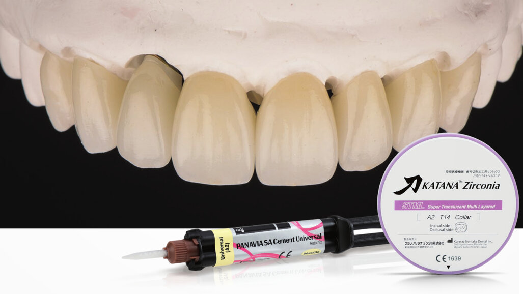 How to cement restorations made of high-translucency zirconia