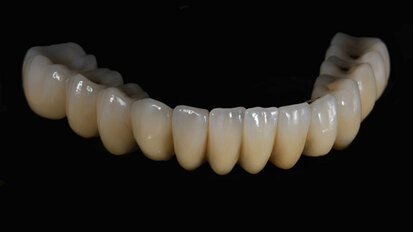 Dubai Produces First 3D Printed Teeth