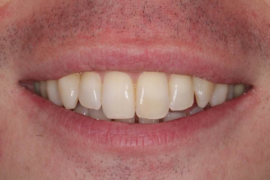 Fig. 15: Post-treatment smile