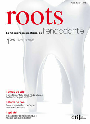 roots France No. 1, 2013