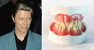 Scheef gebit van Bowie herleeft door kunstenaar