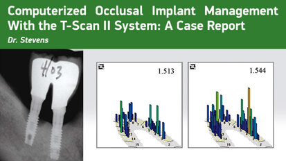 Computerized Occlusal Implant Management With the T-Scan II System: A Case Report