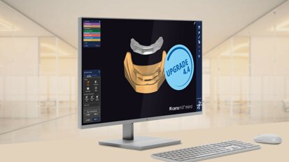 Ceramill software Upgrade 4.4 focuses on time-savings and expands indications
