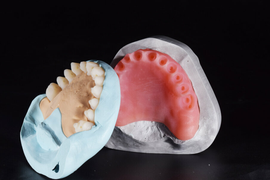 Fig. 18: Silicone wall for fixing the denture teeth in their defined positions in the maxillary denture base (CediTEC Adhesive).