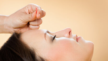 Wie wirksam ist Akupunktur bei einer Dentalphobie?