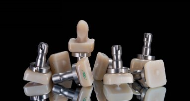 A chairside CAD/CAM lithium disilicate block in the hands of the dental technician: Giving that extra touch