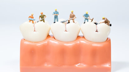 Largest study to date on dental caries experience in Norwegian adult population