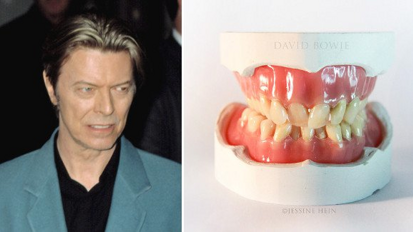 Interview : «  Les dents de Bowie étaient comme tout le reste chez lui : différentes »