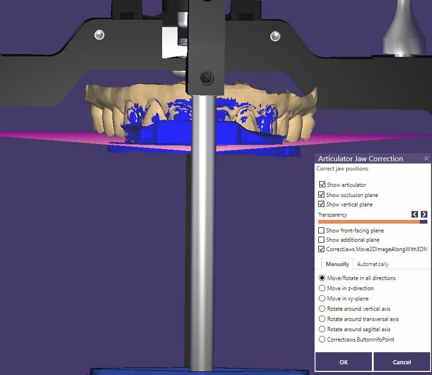 Fig. 9: Frontal view of the model orientation based on the horizontal plane of the virtual articulator.
