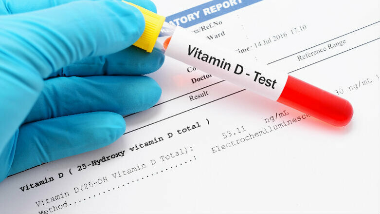 Focus sulla Vitamina D: dati di efficacia alla luce delle evidenze scientifiche attuali