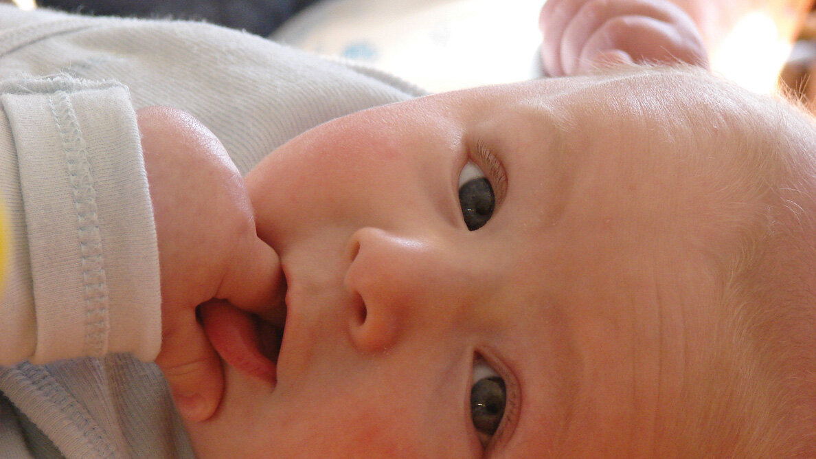 AAOMS seeks insurance coverage for congenital craniofacial anomalies