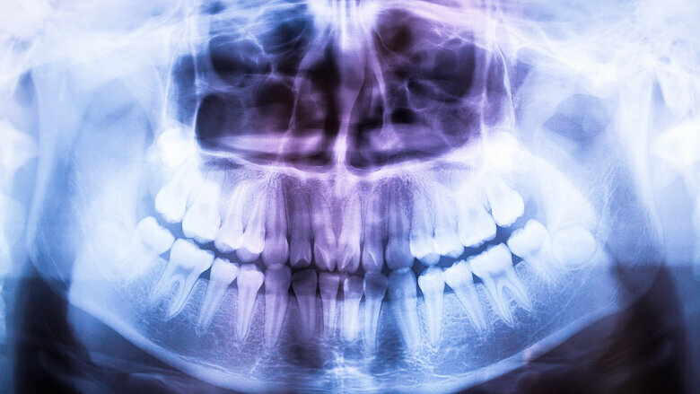 Dentists with greater financial incentive take more radiographs