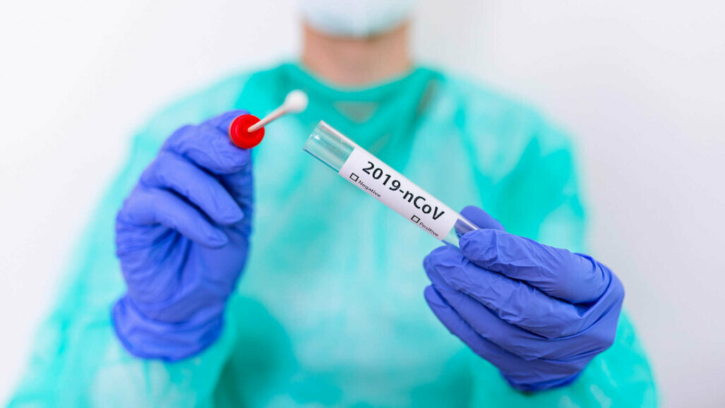 Testiranje stomatoloških pacijenata na SARS-CoV-2