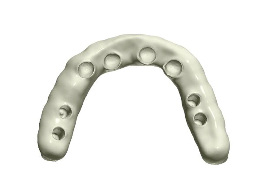 Fig. 10: Ready-made project of the supra-structure visible from the intragingival side.