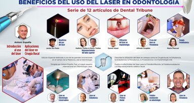 Los beneficios del láser en Odontología (1)