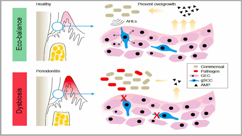 Study identifies cells in gingivae that protect against periodontitis