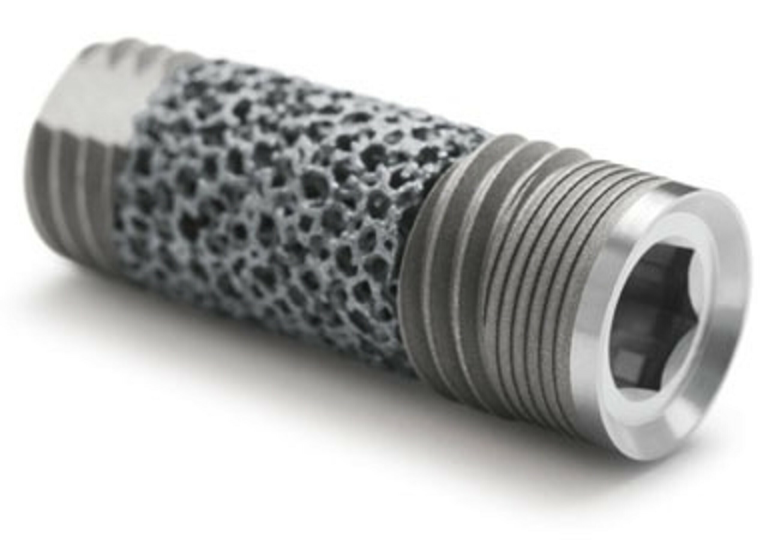 Trabecular Metal Dental Implant