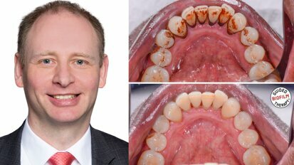Oral biofilm: A concern for all dental professionals