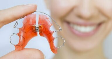 Aparaty retencyjne utrwalą efekt leczenia ortodontycznego