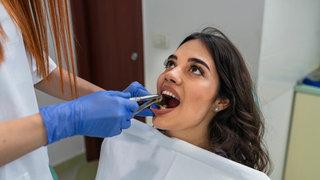 Twee derde tandartsen kreeg verzoek  gezonde elementen te extraheren