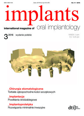 implants Poland No. 3, 2016