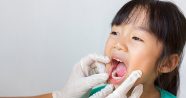 Sealed primary molars reduce caries risk