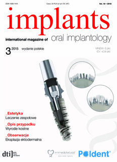implants Poland No. 3, 2015
