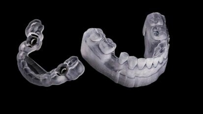 Digitalização do padrão ouro de implantodontia