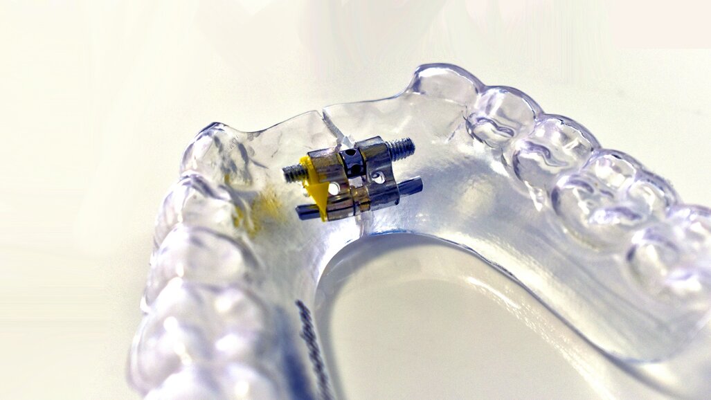 Certificación en la nueva Técnica Hybrid de Ortodoncia