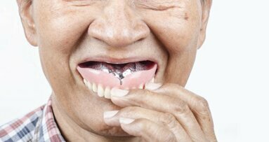 戴义齿入睡会增加高龄人群患肺炎的风险