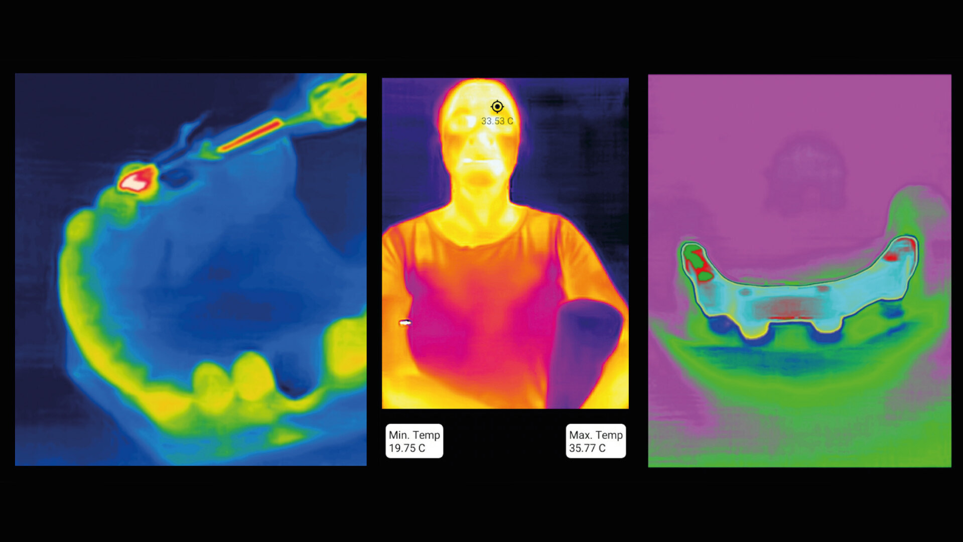 DT News International Dental Thermal App offers “a simple, yet