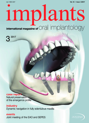 implants international No. 3, 2017