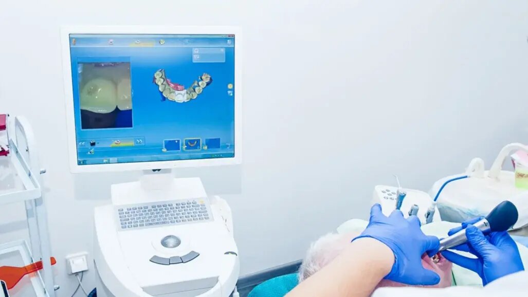 Revisão acadêmica de aplicações CAD/CAM dentro da Odontologia