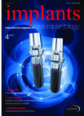 implants international No. 4, 2012