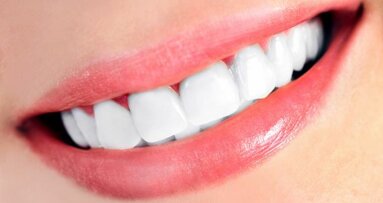 “EU-regels voor tandenbleken werken averechts”