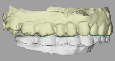 Impression 3D : la nouvelle mode en chirurgie dentaire ?