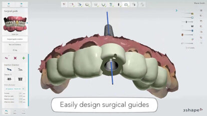 Implantology the digital way by 3Shape