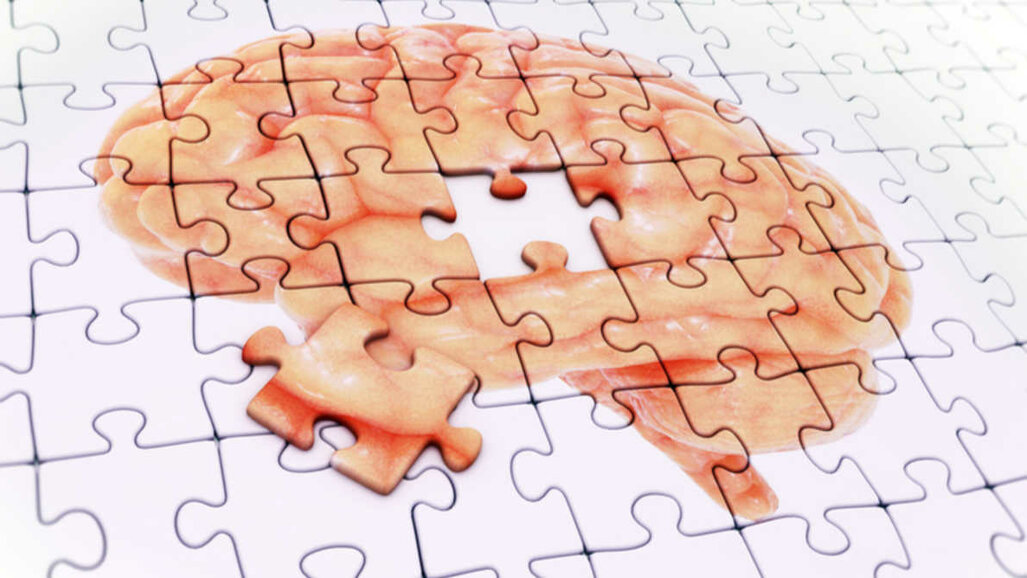 Uno studio conferma come la recessione gengivale aumenti il rischio di sviluppare l’Alzheimer