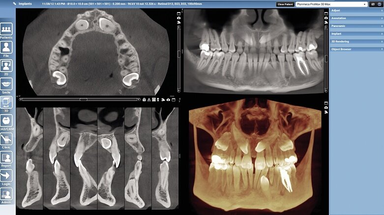 Planmeca software allows multiple applications for dental facilities