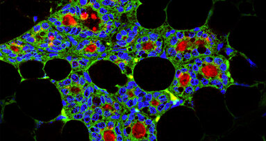 Dentale Stammzellen können milchproduzie­rende Zellen erzeugen