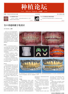 Implant Tribune China No. 4, 2016
