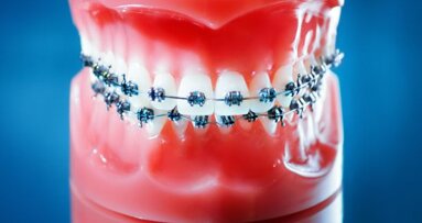Strengere eisen voor buitenlandse tandarts-specialisten